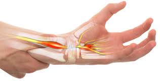 Mana, un simbol puternic al civilizatiilor de pretutindeni. Sindrom De Tunel Carpian Kineto Land