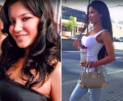Svetlana Bilyalova Celebrity Plastic Surgery Hair Beauty My Hair
