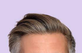 Signs and symptoms of hair loss may include: Reasons Men Don T Discuss Hair Loss 15 Minutes By Cornerstone