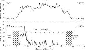 However, it needs to be used as part of a detox method if you want to remove all of the drug toxins so that you can test negative. A Review Of Bioanalytical Techniques For Evaluation Of Cannabis Marijuana Weed Hashish In Human Hair Bmc Chemistry Full Text