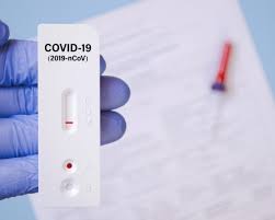 Fast Antigen Tests Are The New Hope Of Air Travel Tr