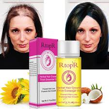 Hot fast sunburst andrea fast hair growth pilatory essence human hair oil baldness anti hair loss invalid refund alopecia product ingredients: 20ml Hair Oil Fast Hair Growth Essence Human Baldness Natural Herbal Powerful Hair Growth Treatment Fluid Anti Hair Loss Hair Scalp Treatments Aliexpress