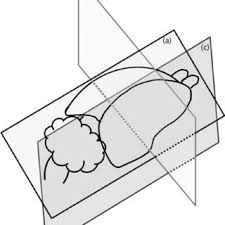 Are you sure you want to remove stereotaxic atlas of the human brainstem and. Pdf Techniques And Methods Of Animal Brain Surgery Perfusion Brain Removal And Histological Techniques