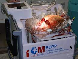 La Incubadora De Los Pulmones Tecnologia Medica Elmundo Es
