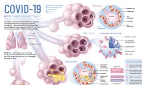 Organs are specialised body parts, each with their own jobs. Visualizing What Covid 19 Does To Your Body Visual Capitalist