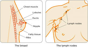 There are more than 100 types of cancer, including breast cancer, skin cancer, lung cancer, colon cancer, prostate cancer, and lymphoma. Primary Breast Cancer Breast Cancer Now