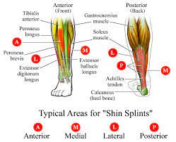 Shin Splints Ultra Runningultra Running