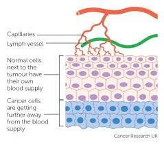 Treatment options depend on the type of cancer, its stage, if the cancer has spread and your general health. How Cancers Grow Cancer Research Uk
