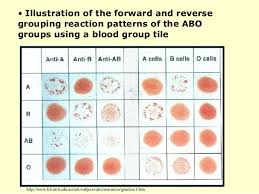 blood typing ppt