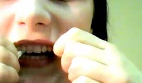 How to make fake realistic looking braces. Brace Yourself For Diy Orthodontia Dentistry Today