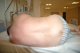 This position involves the patient lying on either her right or left side. Epos Trade