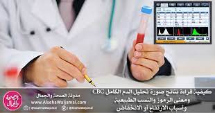 Complete blood count)، وهو أحد تحاليل الدم الشائعة التي تُساعد في تشخيص الأمراض، والتي يتضمن تحليل cbc قياس مستوى خلايا الدم الحمراء والبيضاء بشكل أساسي، إضافة إلى العديد من التحاليل الأخرى التي قد. ÙƒÙŠÙÙŠØ© Ù‚Ø±Ø§Ø¡Ø© Ù†ØªØ§Ø¦Ø¬ ØµÙˆØ±Ø© ÙØ­Øµ ØªØ­Ù„ÙŠÙ„ Ø§Ù„Ø¯Ù… Ø§Ù„ÙƒØ§Ù…Ù„ Cbc ÙˆÙ…Ø¹Ù†Ù‰ Ø§Ù„Ø±Ù…ÙˆØ² ÙˆØ§Ù„Ù†Ø³Ø¨ Ø§Ù„Ø·Ø¨ÙŠØ¹ÙŠØ© ÙˆØ£Ø³Ø¨Ø§Ø¨ Ø§Ù„Ø§Ø±ØªÙØ§Ø¹ Ø£Ùˆ Ø§Ù„Ø§Ù†Ø®ÙØ§Ø¶