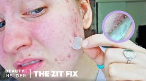 Feb 05, 2021 · if you don't wash your face before you go to sleep,. Microneedle Patch Works To Erase Acne Scars And Dark Spots The Zit Fix Youtube