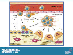 Berikut ini kisah the story of ye chen full episode ! Bone Metastasis Mechanisms Therapies And Biomarkers Physiological Reviews