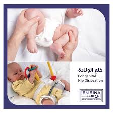 خلع الورك الولادي أو خلع الولادة هو عبارة Ibn Sina Medical Center Jordan مركز ابن سينا للأجهزة الطبية فيسبوك