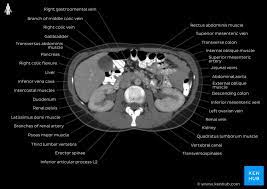 It gains its name from its diamond shape. Radiological Anatomy X Ray Ct Mri Kenhub