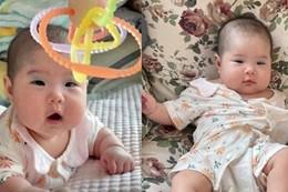 Bé gái có vết bớt hiếm gặp giữa trán, diện mạo hiện tại gây ngỡ ngàng