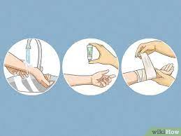 The glochids should come out of the skin and stick to the glue. U Xm7yhy Txlbm