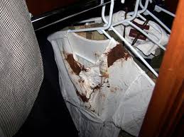 The singer died in 2009. Blood Propofol Baby Dolls Inside Michael Jackson S Terrifying Death Room