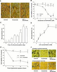 Therefore, understanding the emergent management of such cases is essential. Chronic Lithium Treatment Robustly Protects Neurons In The Central Nervous System Against Excitotoxicity By Inhibiting N Methyl D Aspartate Receptor Mediated Calcium Influx Pnas