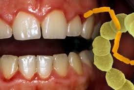 Mundfaule Stomatitis Bei Babys Kindern