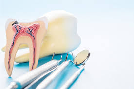 But you should be prepared to spend about 90 minutes in the dentist's chair for a root canal. Do You Need A Root Canal Treatment Before Getting A Crown Or Bridge Ear Nose Throat And Dental Problems Articles Body Health Conditions Center Steadyhealth Com