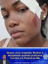 Quase virou tragédia: mulher é atropelada quando praticava corrida em  Pedreiras-Ma. O acidente de ocorreu na madrugada dessa quinta-feira (19) de  setembro, de frente ao hospital nossa senhora das graças, localizado na