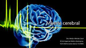 Todo sobre muerte cerebral, noticias en imagenes, fotos, videos, audios, infografias, interactivos y diferencia entre un coma y muerte cerebral. Muerte Cerebral