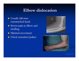 Image result for Elbow Exam