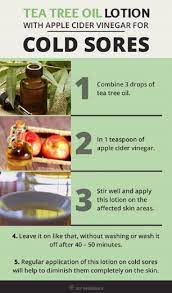 Tea Tree Oil Remedy For Cold Sores 11 Quick And Natural Diy Cold Sore Remedies Cold Sores Remedies Natural Remedies Remedies