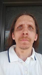 My dad and my grandma (dad's mom). Both carriers of the NF gene. All three  of us have different severities. Grandma has the most fibromas has has  survived cancer at least twice.