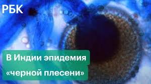Возможно, что индийский штамм, а также более длительное лечение от него, ослабляют организм человека и иммунную систему гораздо это определённые виды чёрной плесени — грибов, способных поражать человека, а также домашних животных и сельхоз животных. Novaya Infekciya V Indii Chernaya Plesen Porazhaet Mozg I Legkie Posle Koronavirusa Youtube