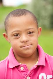 C'est en gironde que se sont déroulés les faits. Garcon De 9 Ans Atteint Du Syndrome De Down Banque D Images Et Photos Libres De Droits Image 33604660