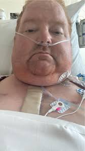 Seinfeld quote about sternotomy and laughter