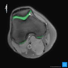 Knee muscles need to have both good strength and flexibility. How To Read The Normal Knee Mri Kenhub