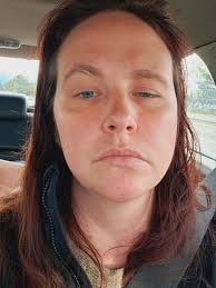 Does anyone else get pain only