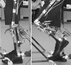 Wear the hinged knee brace at all times when ambulating. The Stance Control Knee Mechanism Locking The Knee During Stance Left Download Scientific Diagram