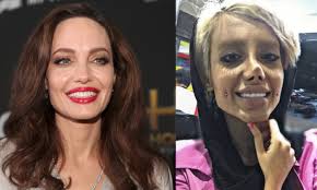 It is a popular practice worldwide, with many alternative stores and tattoo parlors setting up booths for customers. Instagram Starlet Does Extreme Body Modification To Look Like Angelina Jolie Brandscovery