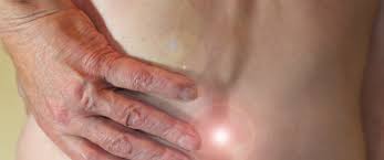 سرطان العمود الفقري تصنيفات وأعراض وعلاجات ويب طب