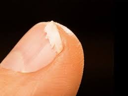 En finir avec les ongles mous et cassants. Ongles Cassants