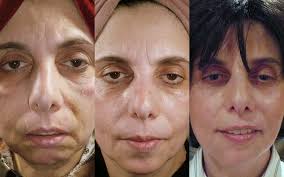 Before and After Gallery