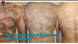 How can i get a tattoo removed? Average Cost For Tattoo Removal All You Must To Learn About Tattoo Remove Youtube
