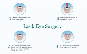 In general, lasik eye surgery should not take longer than 30 minutes. Lasik Eye Surgery Near Boynton Beach Lake Worth Fl