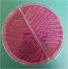 A microbial biorealm page on the genus salmonella typhi. Ovarian Abscess Caused By Salmonella Enterica Serovar Typhi A Case Report Journal Of Medical Case Reports Full Text