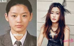 Her title song, meaning of living as well as her old hit songs including love battery will be included in the album. Want To Find Out About The Jun Ji Hyun Plastic Surgery Plastytalk