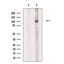 Antibodies are are affinity purified using solid phase goat igg. Vdac1 Antibody Mybiosource