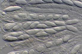 Image result for Microglossa densiflora