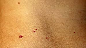 Iar pretul mi se pare mai mult decat. Pete Mici Rosii Pe Maini