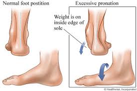 Mungkin punca sakit tu dari tumit. Sakit Tumit Bila Bangun Pagi 7 Perkara Tentang Plantar Fasciitis Kena Tahu