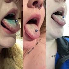 Swelling of the face, lips, and tongue can happen quickly in people who take an. Progression Of Tongue Swelling Pt 2 Days 4 6 Almost Back To Normal Hope This Helps Someone Down The Line Piercing